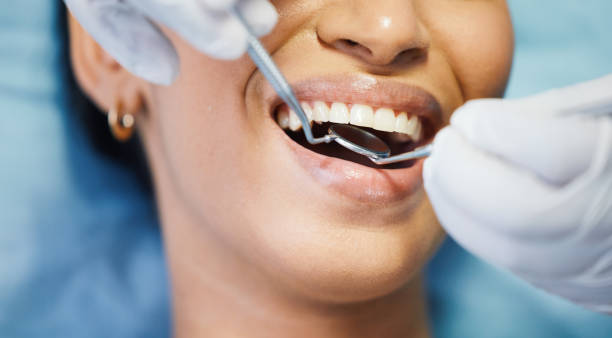 Best Pediatric Emergency Dentist in Redwood City, CA